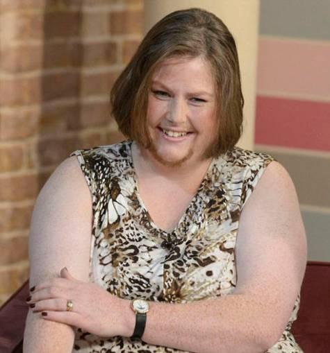 Стигматы, самовозгорания и другие необъяснимые загадки человеческого тела