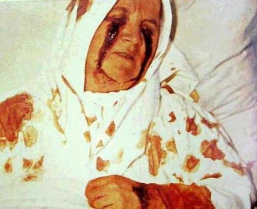 Стигматы, самовозгорания и другие необъяснимые загадки человеческого тела