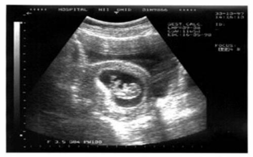 Стигматы, самовозгорания и другие необъяснимые загадки человеческого тела