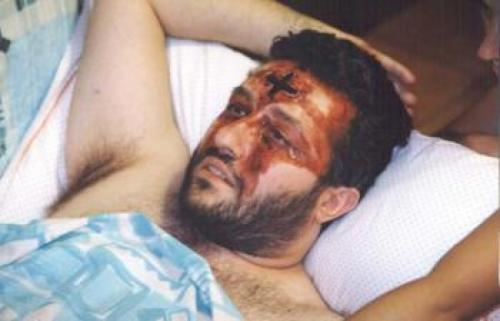 Стигматы, самовозгорания и другие необъяснимые загадки человеческого тела