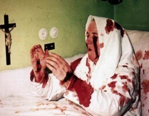 Стигматы, самовозгорания и другие необъяснимые загадки человеческого тела