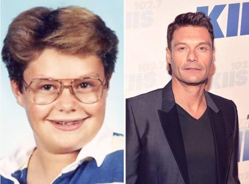 Звезды, которые из гадких утят превратились в прекрасных лебедей