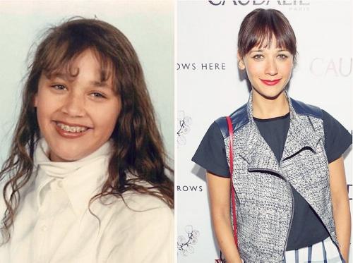 Звезды, которые из гадких утят превратились в прекрасных лебедей