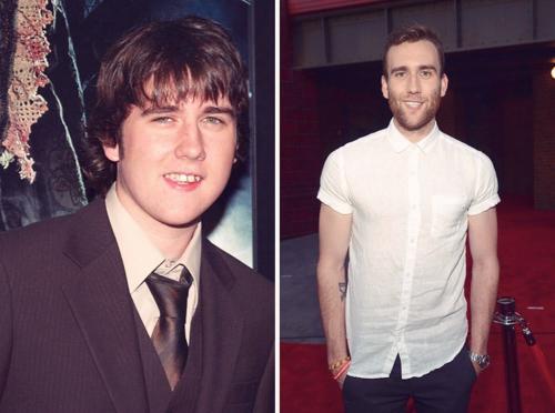 Звезды, которые из гадких утят превратились в прекрасных лебедей