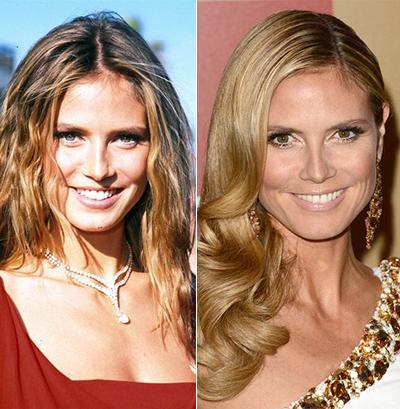 Супермодели тогда и сейчас