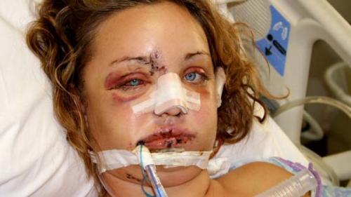 Выпасть из самолета и выжить: самые невероятные случаи спасения в воздухе