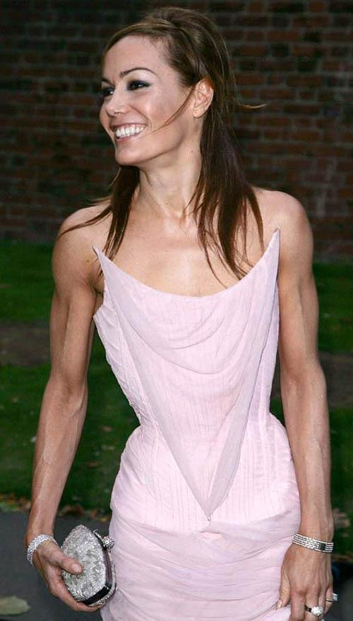 Кошмарно исхудавшая Мадонна и другие жертвы фитнеса