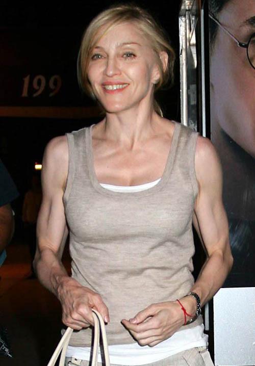 Кошмарно исхудавшая Мадонна и другие жертвы фитнеса