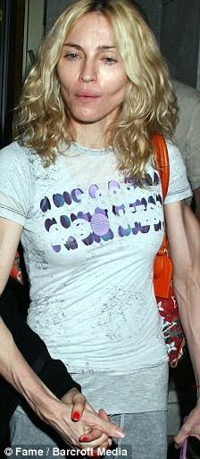 Кошмарно исхудавшая Мадонна и другие жертвы фитнеса