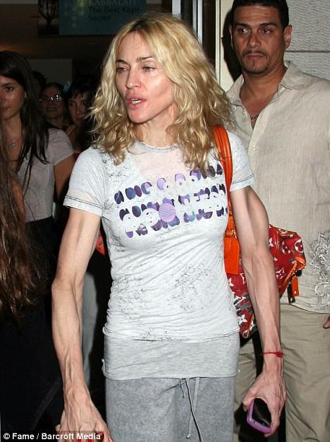 Кошмарно исхудавшая Мадонна и другие жертвы фитнеса