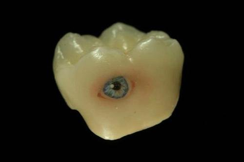 Тату на зубах — для детей и взрослых