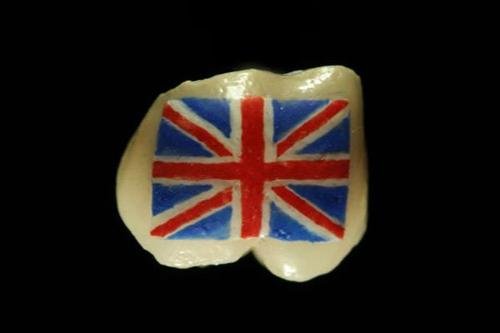 Тату на зубах — для детей и взрослых