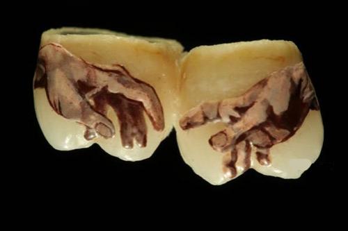 Тату на зубах — для детей и взрослых