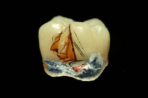 Тату на зубах — для детей и взрослых