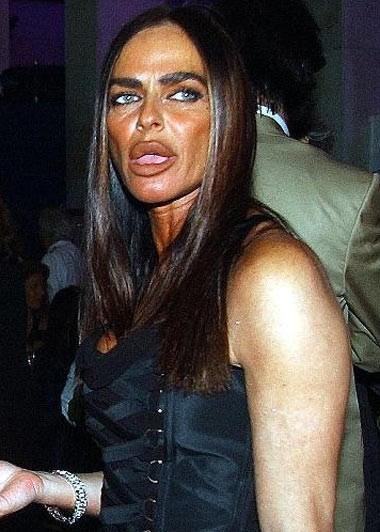 Топ-10 звезд, ставших жертвами пластической хирургии