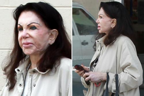 Топ-10 звезд, ставших жертвами пластической хирургии