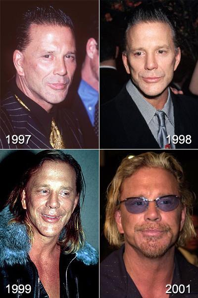 Топ-10 звезд, ставших жертвами пластической хирургии