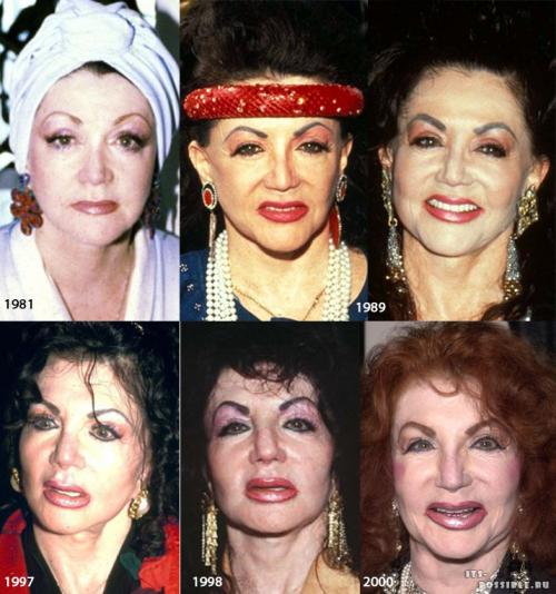 Топ-10 звезд, ставших жертвами пластической хирургии