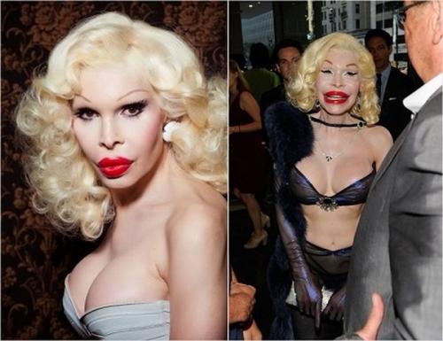 Топ-10 звезд, ставших жертвами пластической хирургии