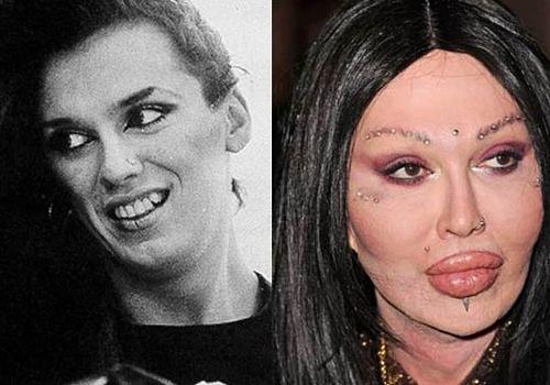 Топ-10 звезд, ставших жертвами пластической хирургии