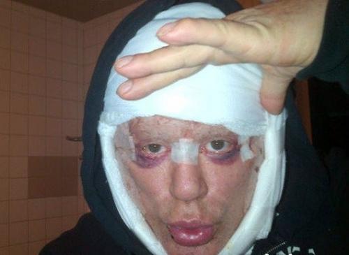 Топ-10 звезд, ставших жертвами пластической хирургии