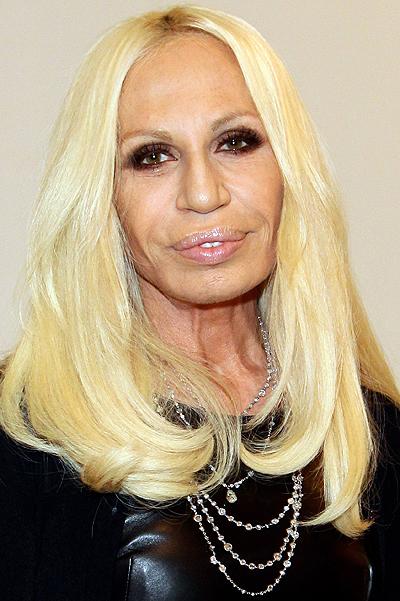 Топ-10 звезд, ставших жертвами пластической хирургии