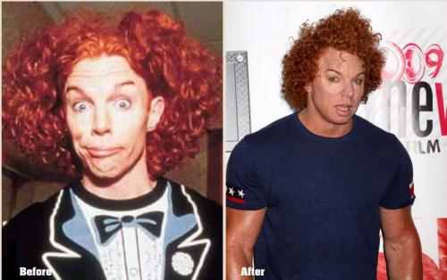 Топ-10 звезд, ставших жертвами пластической хирургии