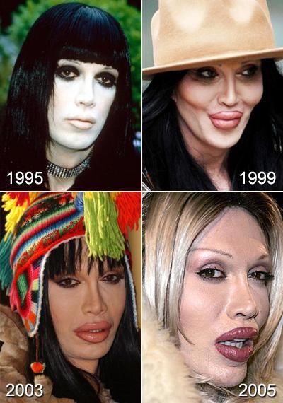 Топ-10 звезд, ставших жертвами пластической хирургии