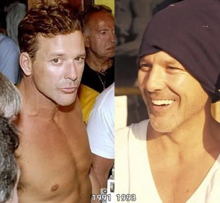 Топ-10 звезд, ставших жертвами пластической хирургии