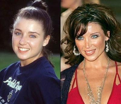 Топ-10 звезд, ставших жертвами пластической хирургии