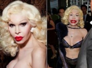 Топ-10 звезд, ставших жертвами пластической хирургии