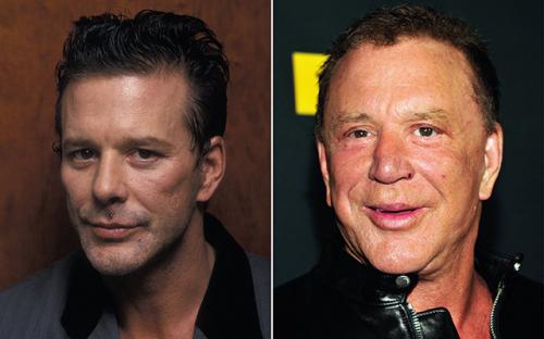 Топ-10 звезд, ставших жертвами пластической хирургии