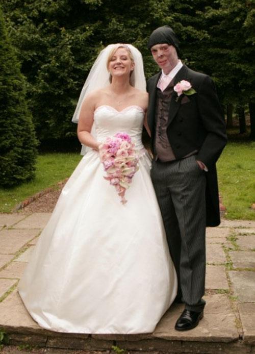 Сгоревший капрал сыграл свадьбу