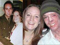 Сгоревший капрал сыграл свадьбу