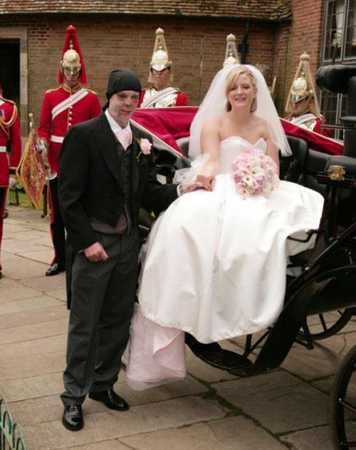 Сгоревший капрал сыграл свадьбу