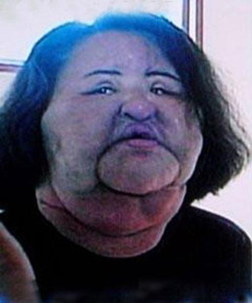 Пластическая хирургия довела кореянку до психушки