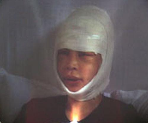 Пластическая хирургия довела кореянку до психушки