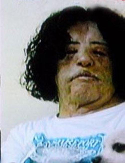 Пластическая хирургия довела кореянку до психушки