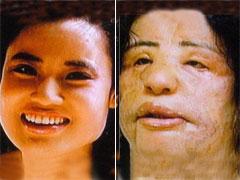 Пластическая хирургия довела кореянку до психушки