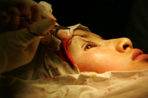 Пластическая хирургия довела кореянку до психушки