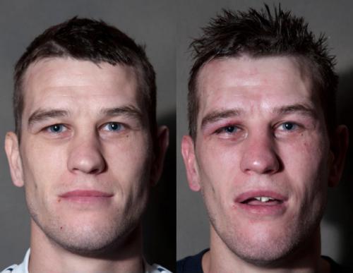 Известные боксеры до и после боя