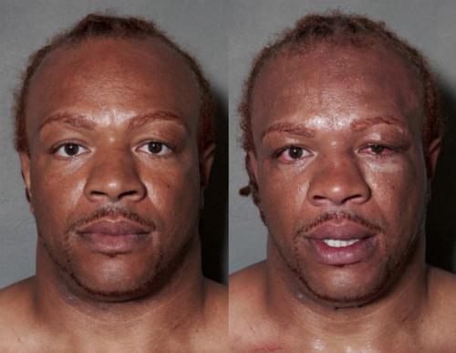 Известные боксеры до и после боя