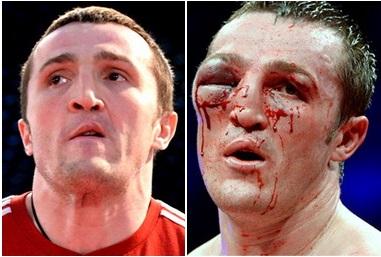 Известные боксеры до и после боя