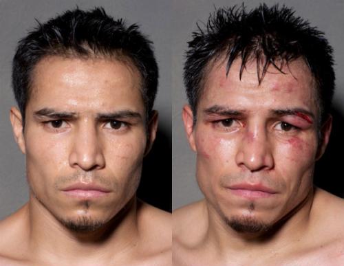 Известные боксеры до и после боя