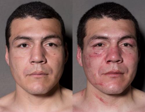 Известные боксеры до и после боя