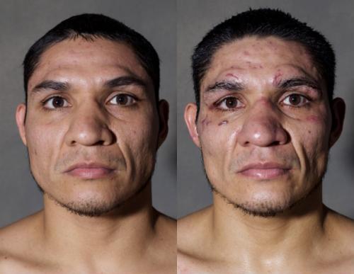 Известные боксеры до и после боя