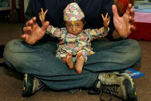 Самые маленькие и самые высокие люди современности