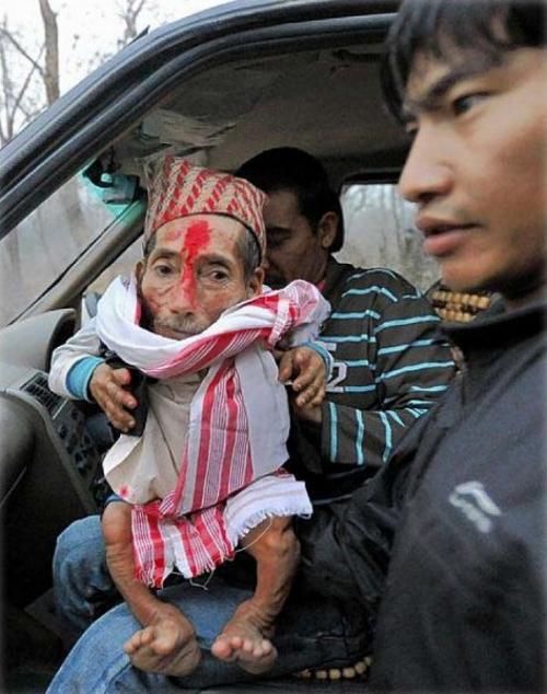 Самые маленькие и самые высокие люди современности