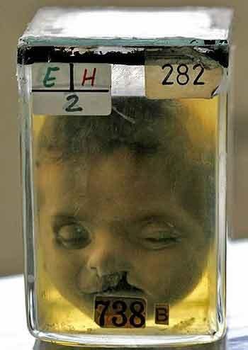 Экскурсия по знаменитым анатомическим музеям мира