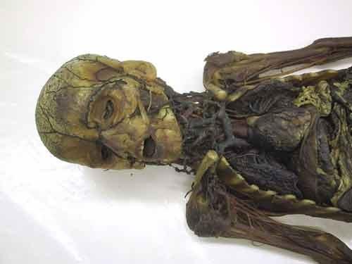 Экскурсия по знаменитым анатомическим музеям мира